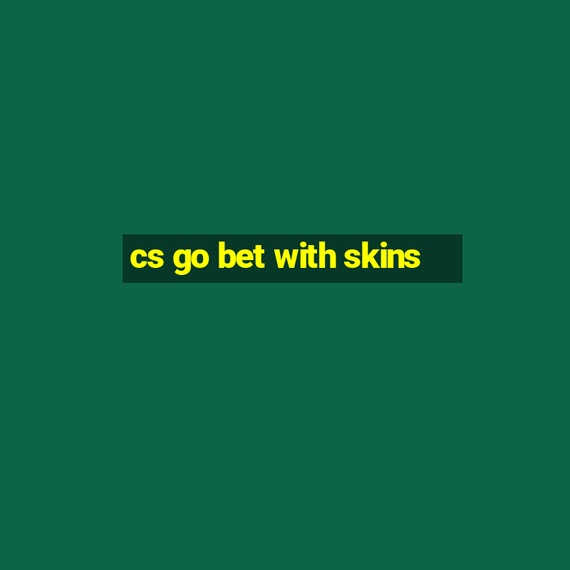 cs go bet with skins