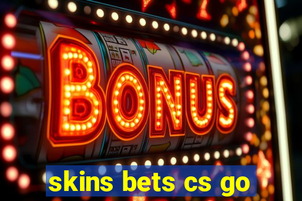 skins bets cs go