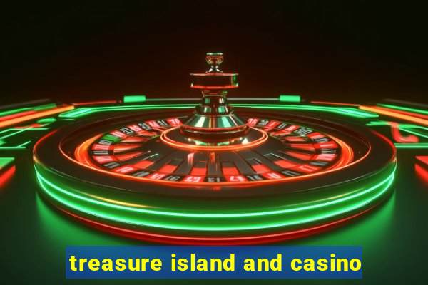 treasure island and casino