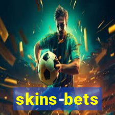 skins-bets