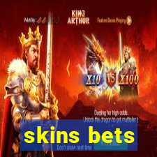 skins bets