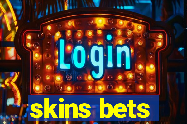 skins bets