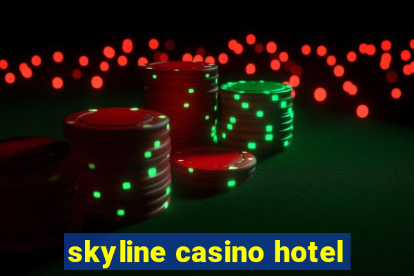 skyline casino hotel