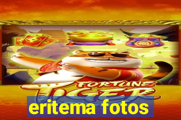 eritema fotos