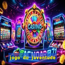 jogo do juventude onde assistir